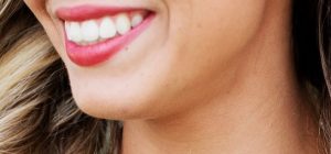 5 Keys to Optimal Dental Health